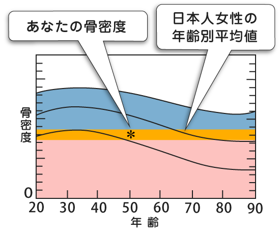 グラフ